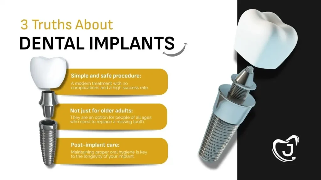 IMPLANTS