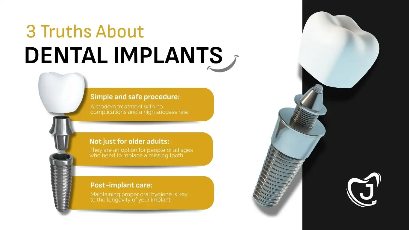 IMPLANTS