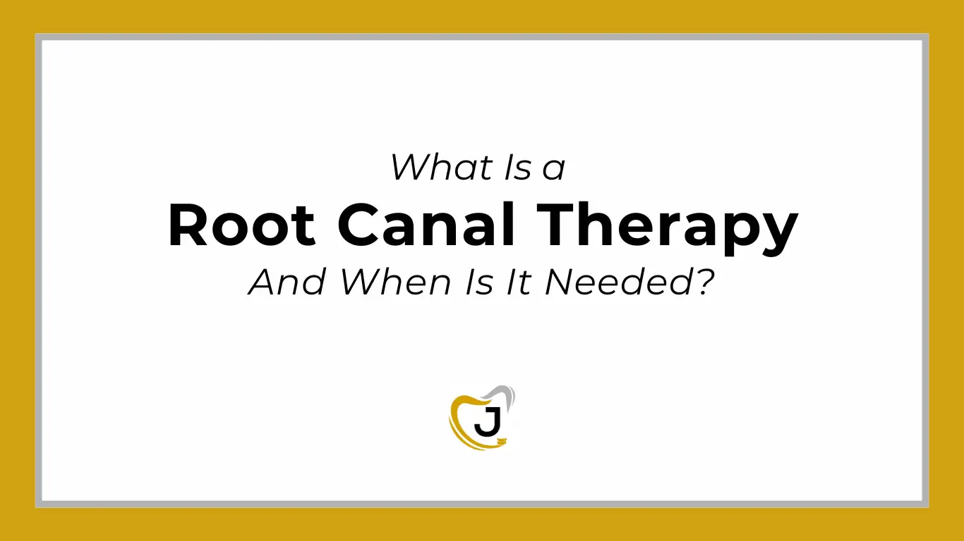 ROOT CANAL